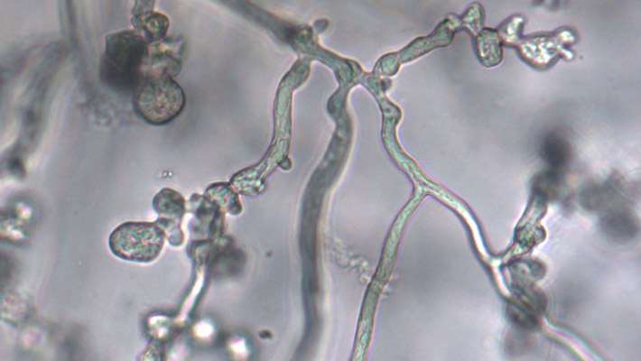 Phytophthora Cinnamomi Fungal Hyphae.